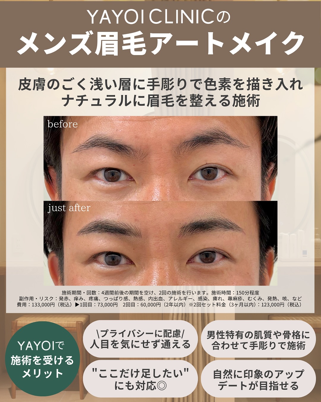 ヤヨイクリニックのメンズ眉毛アート