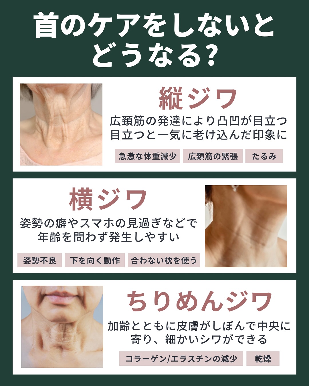 首のケアをしないとどうなる?