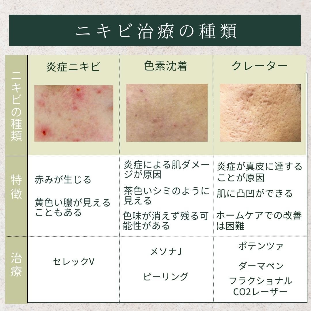 ニキビの種類と治療