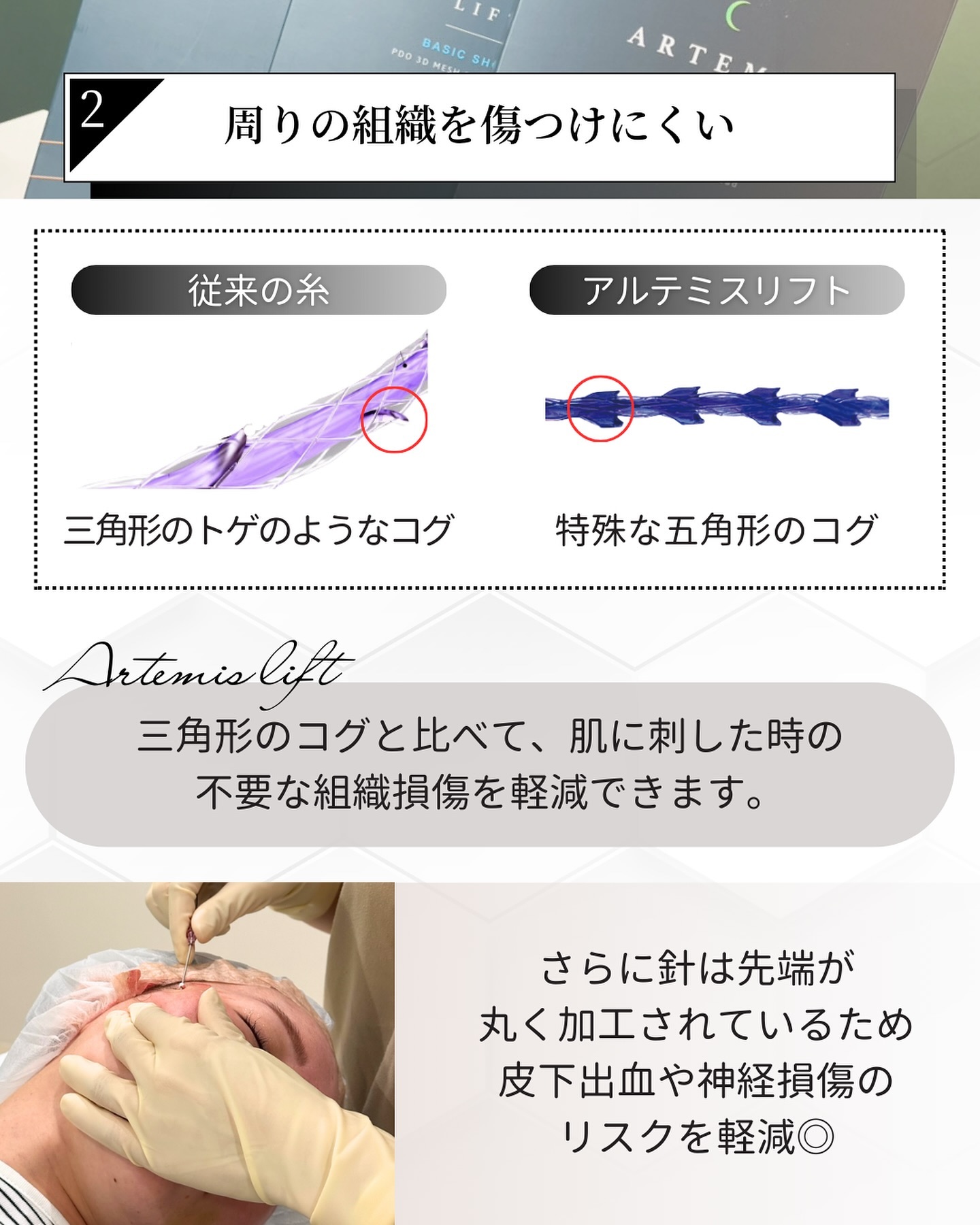アルテミスリフトの特徴