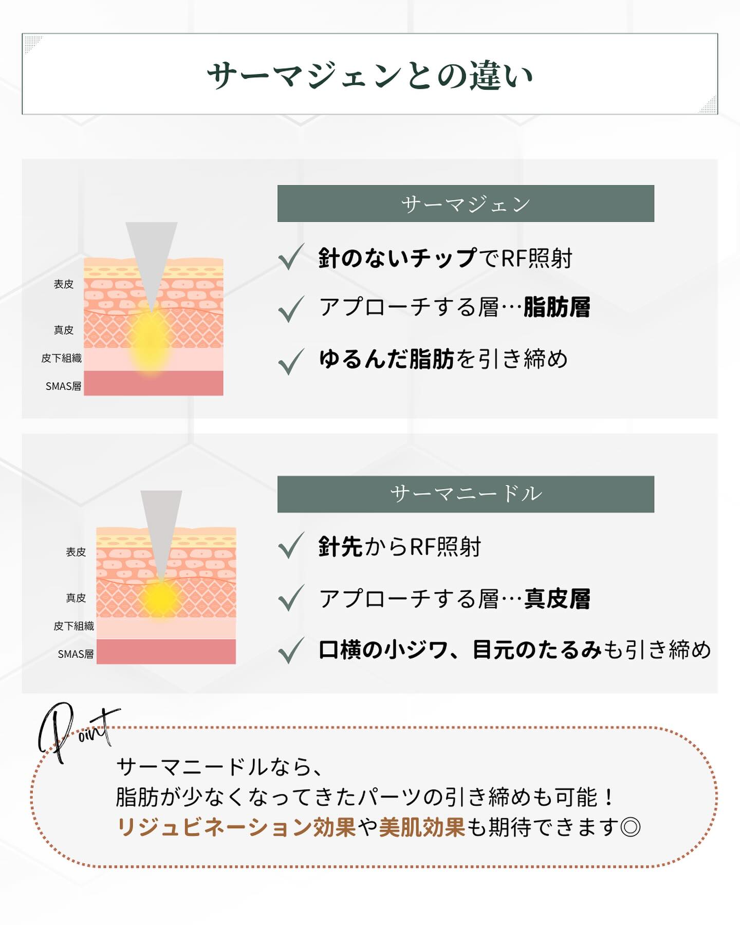 サーマニードルとサーマジェンの違い