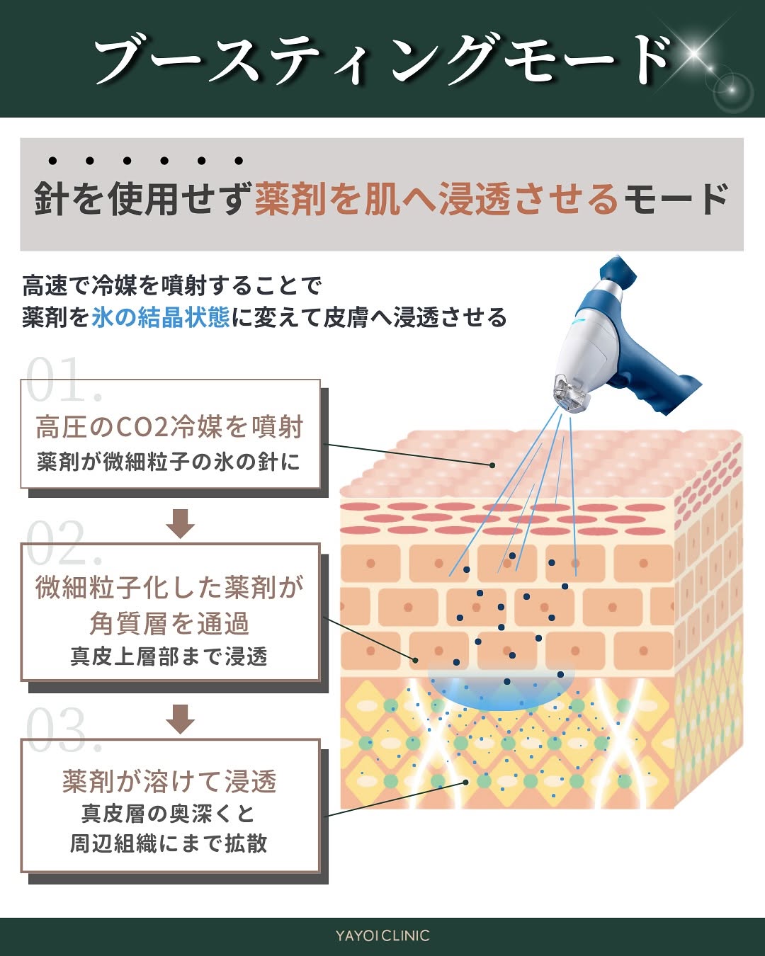 ターゲットクールとは?ブースティングモードについて解説