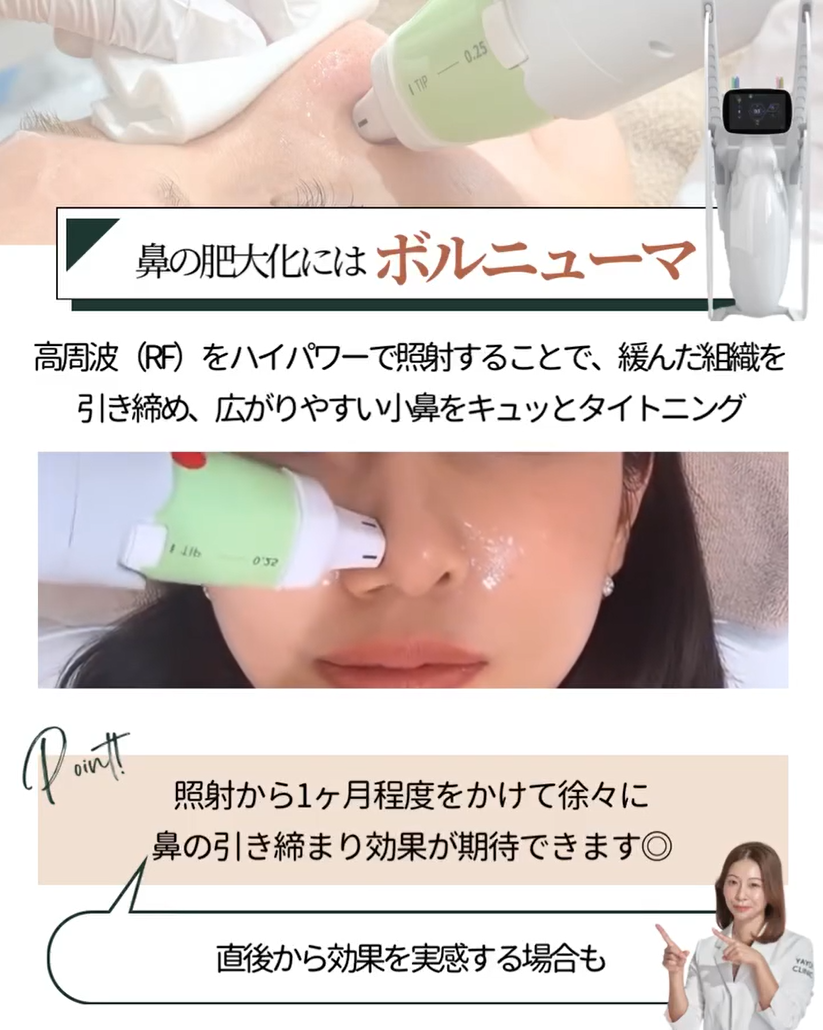 鼻の肥大化にはボルニューマがおすすめ