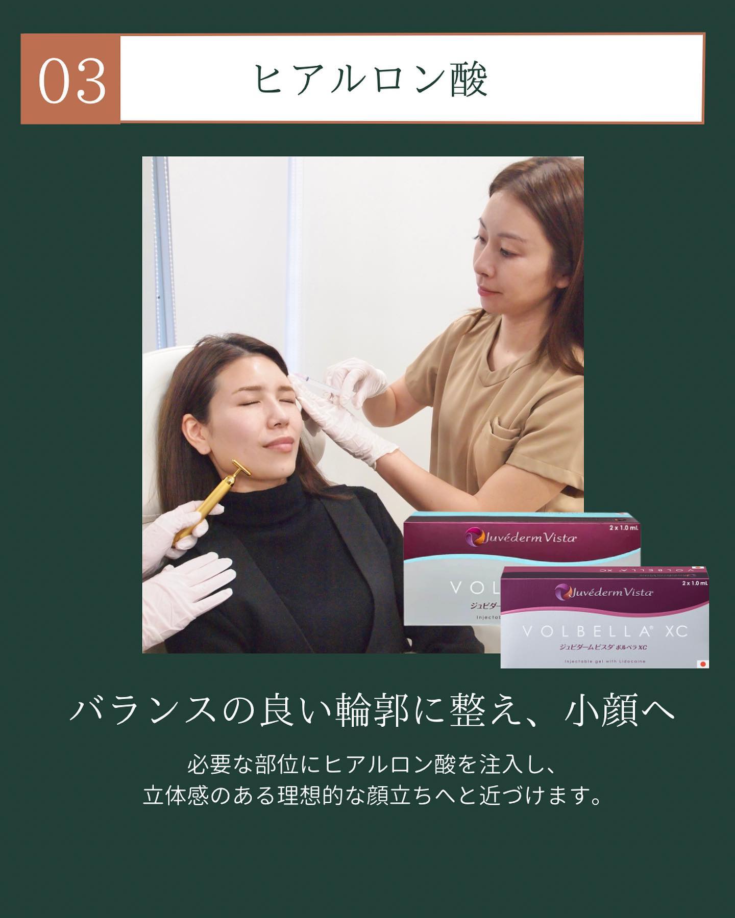 ヒアルロン酸注入
