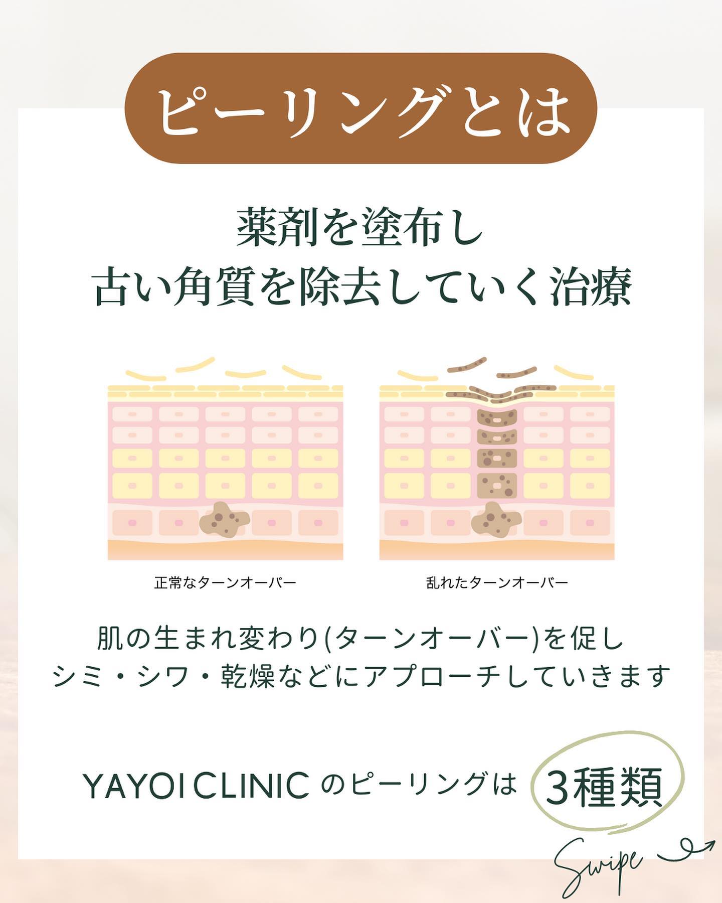 そもそもピーリングとはどんな施術？