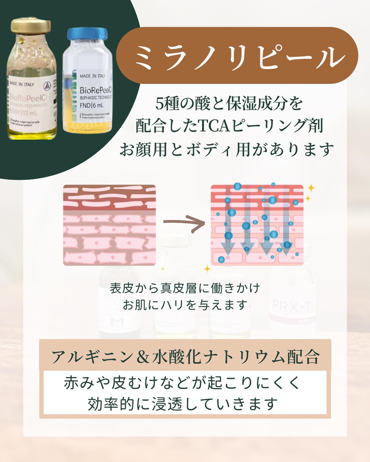ミラノリピールの特徴