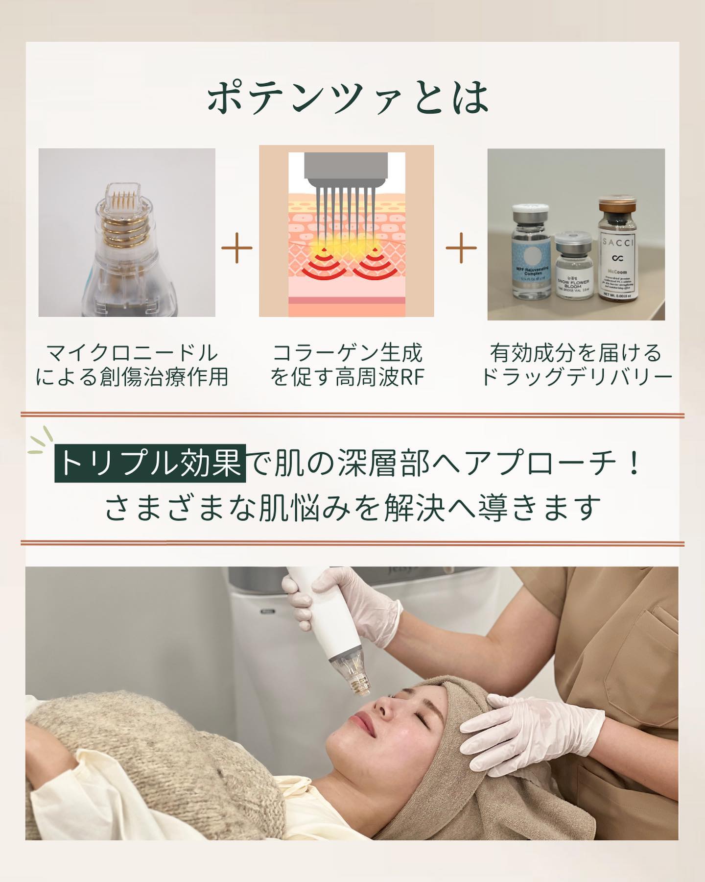 ポテンツァとは
