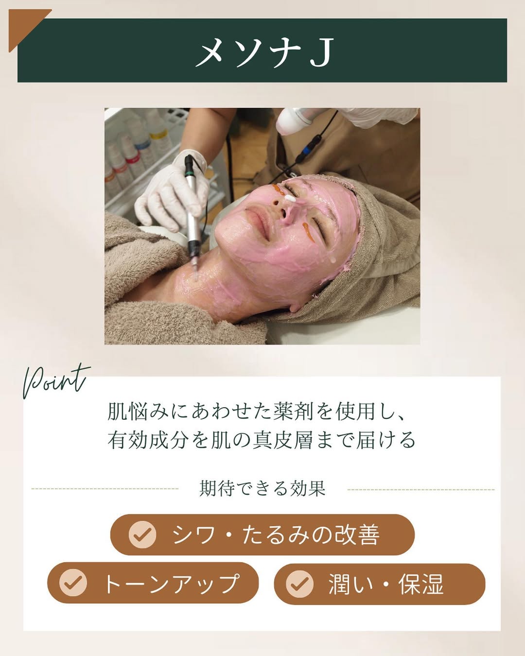 メソナJの特徴