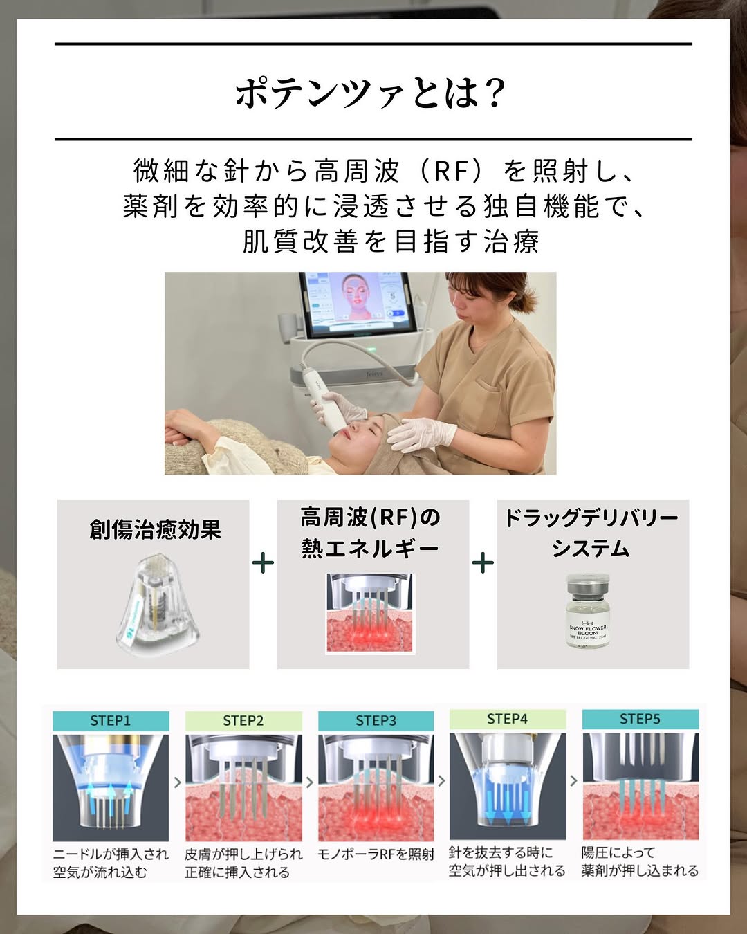 ポテンツァとは?
