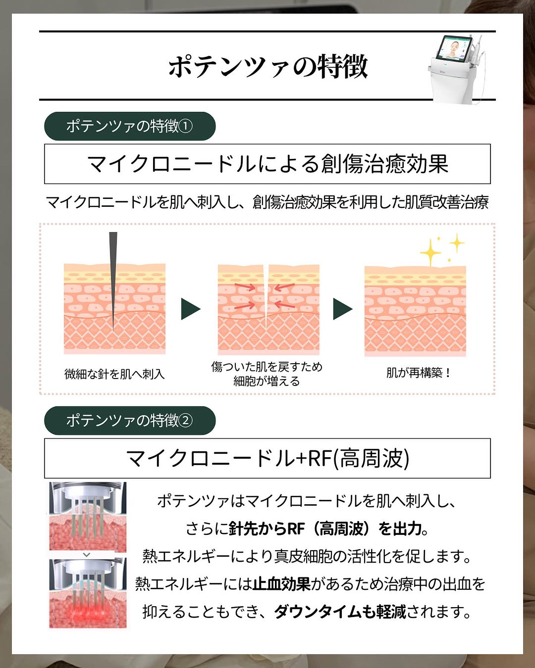 ポテンツァ 創傷治癒効果