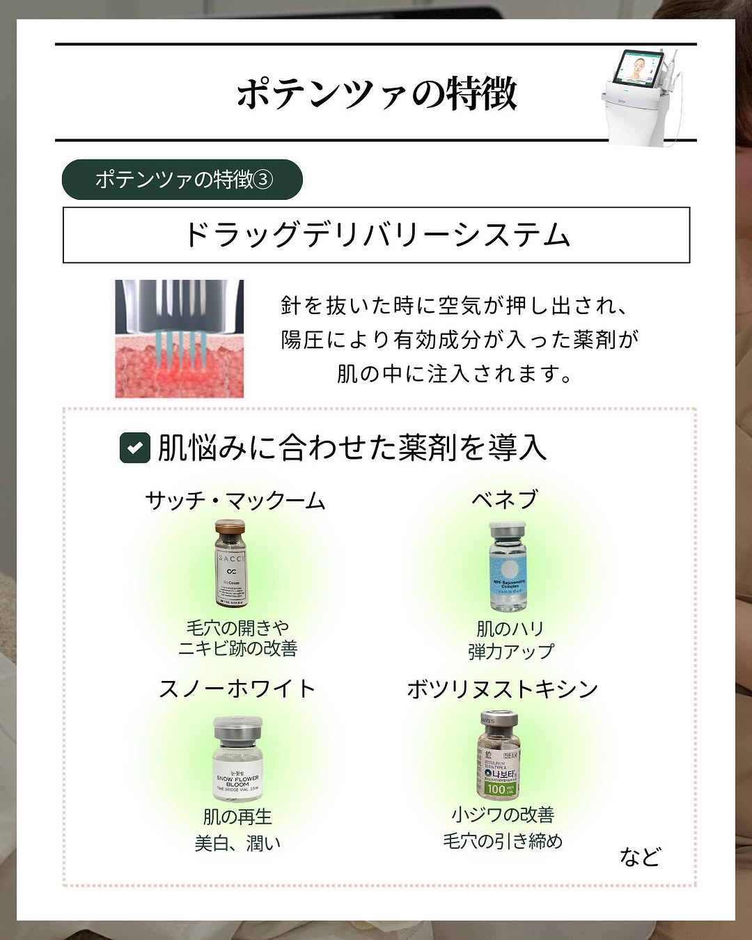 ポテンツァ ドラッグデリバリーシステム