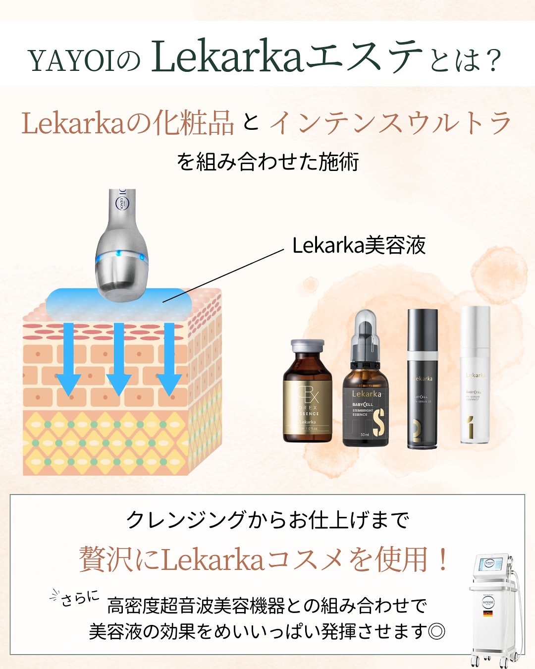 レカルカエステとは