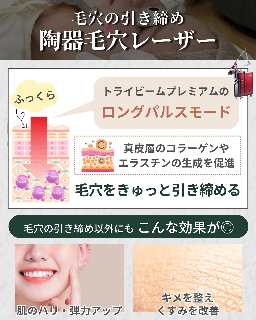 陶器毛穴レーザーの仕組み