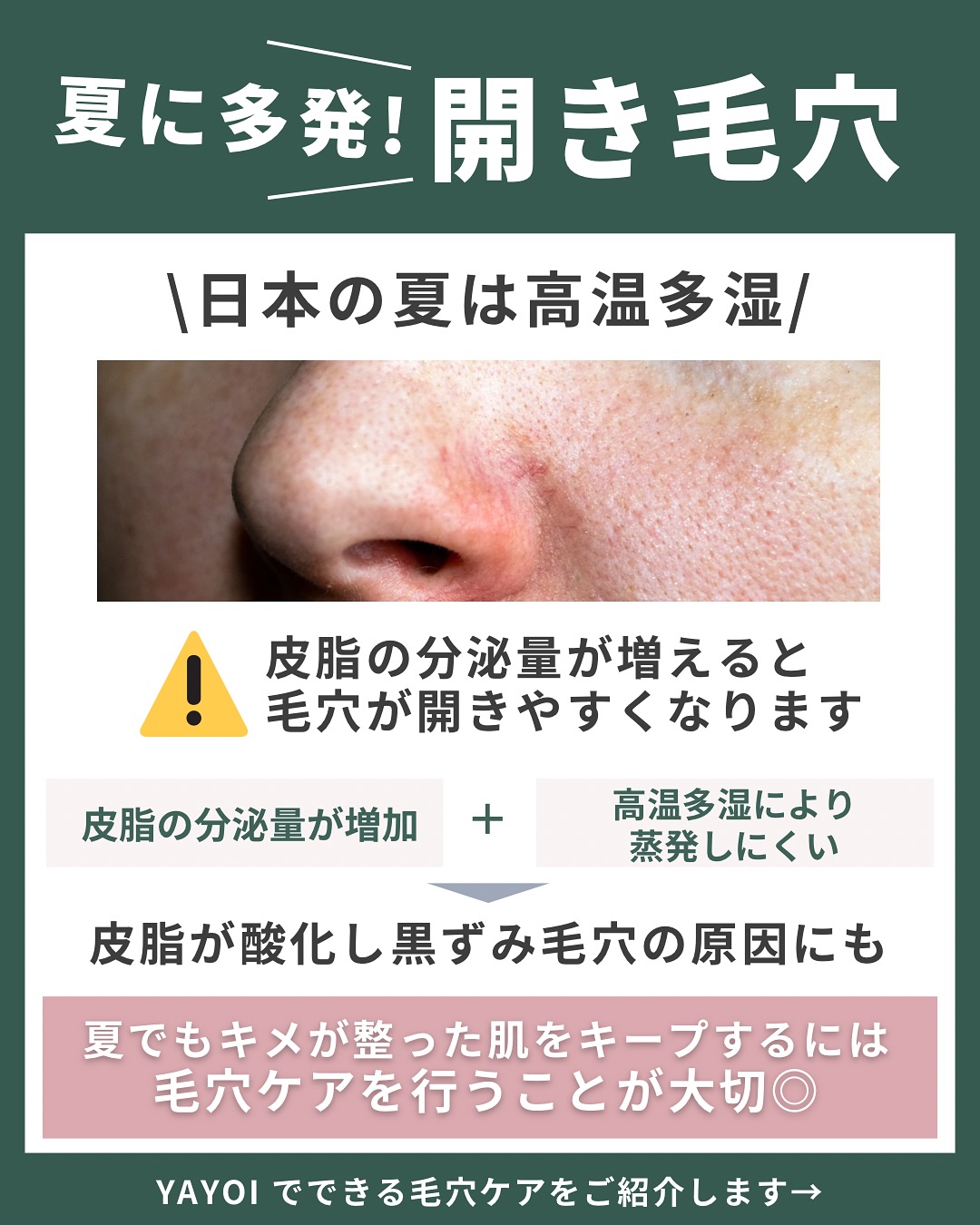 開き毛穴の原因と対策