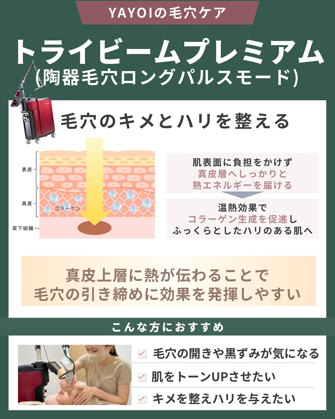 トライビームプレミアム