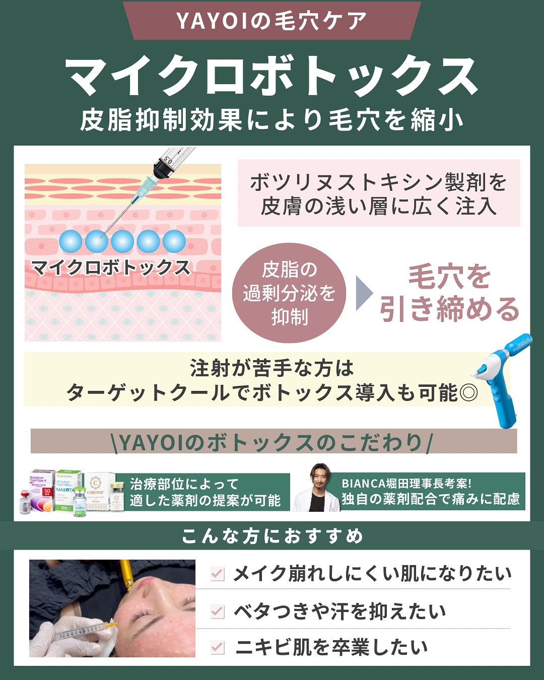 マイクロボトックス