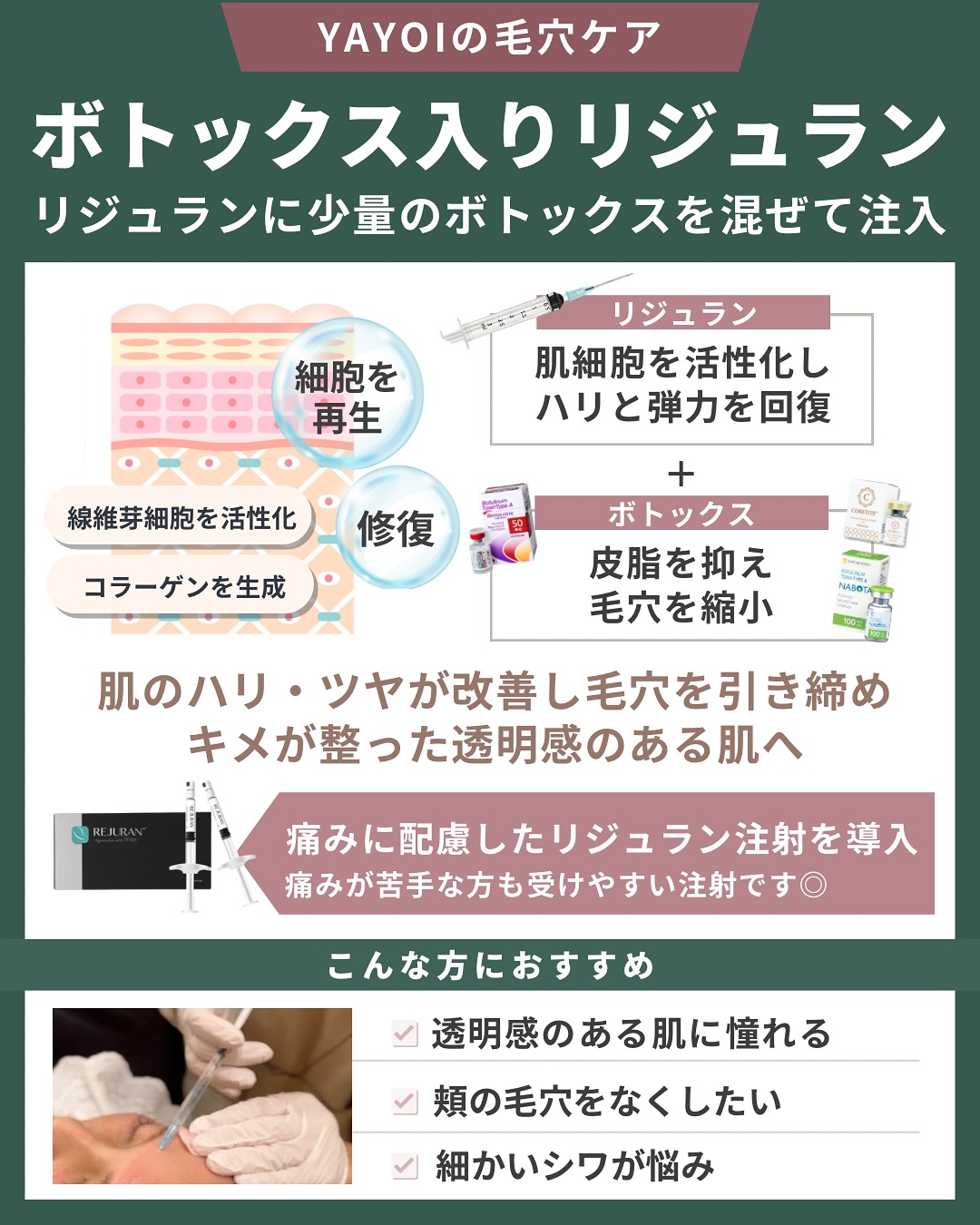 ボトックス入りリジュラン