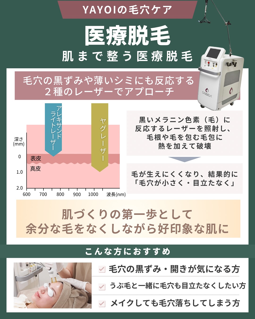 医療脱毛 ジェントルマックスプロプラス
