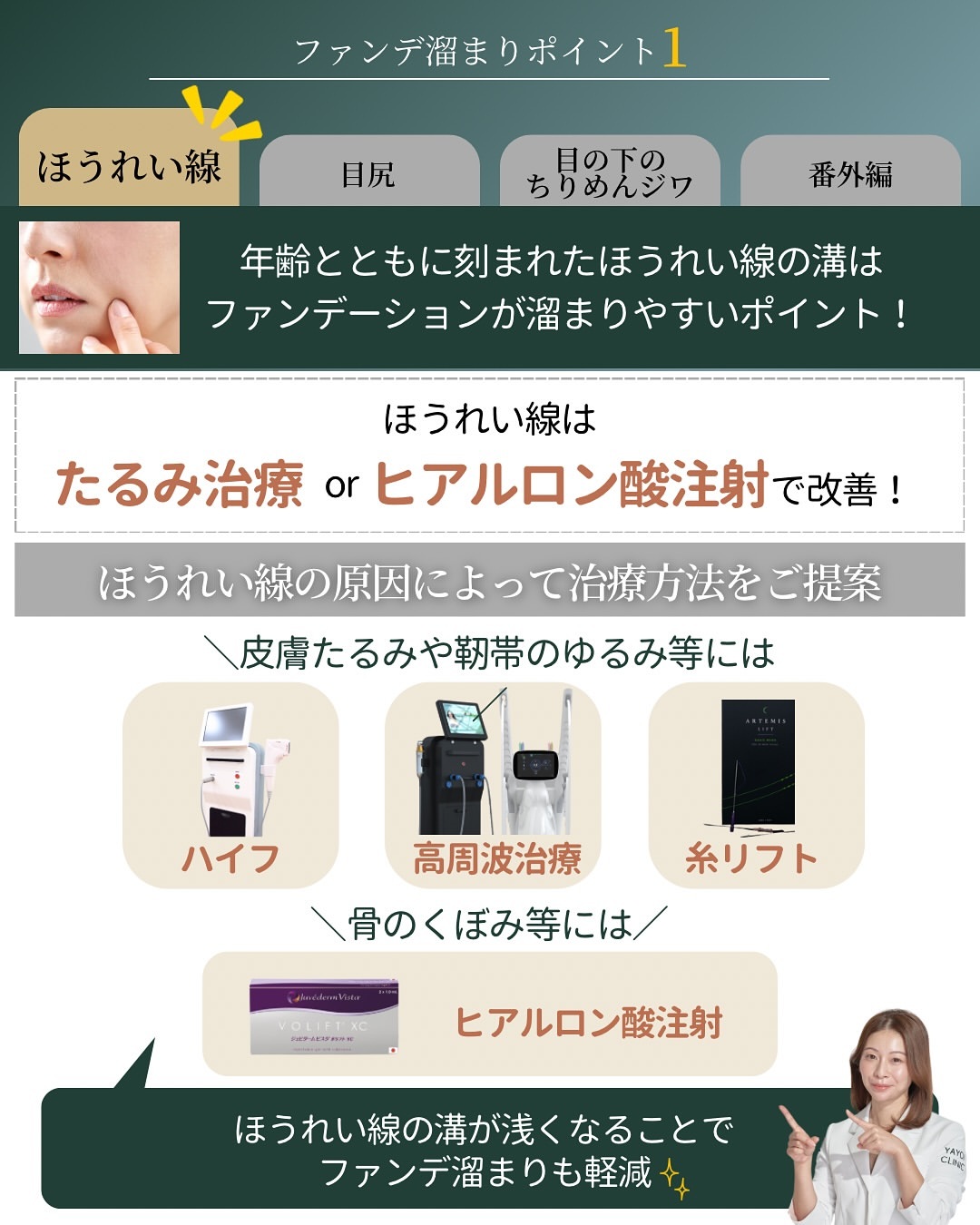 ほうれい線はヒアルロン酸注射