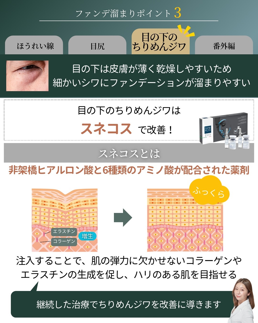 目の下のちりめんジワはスネコス