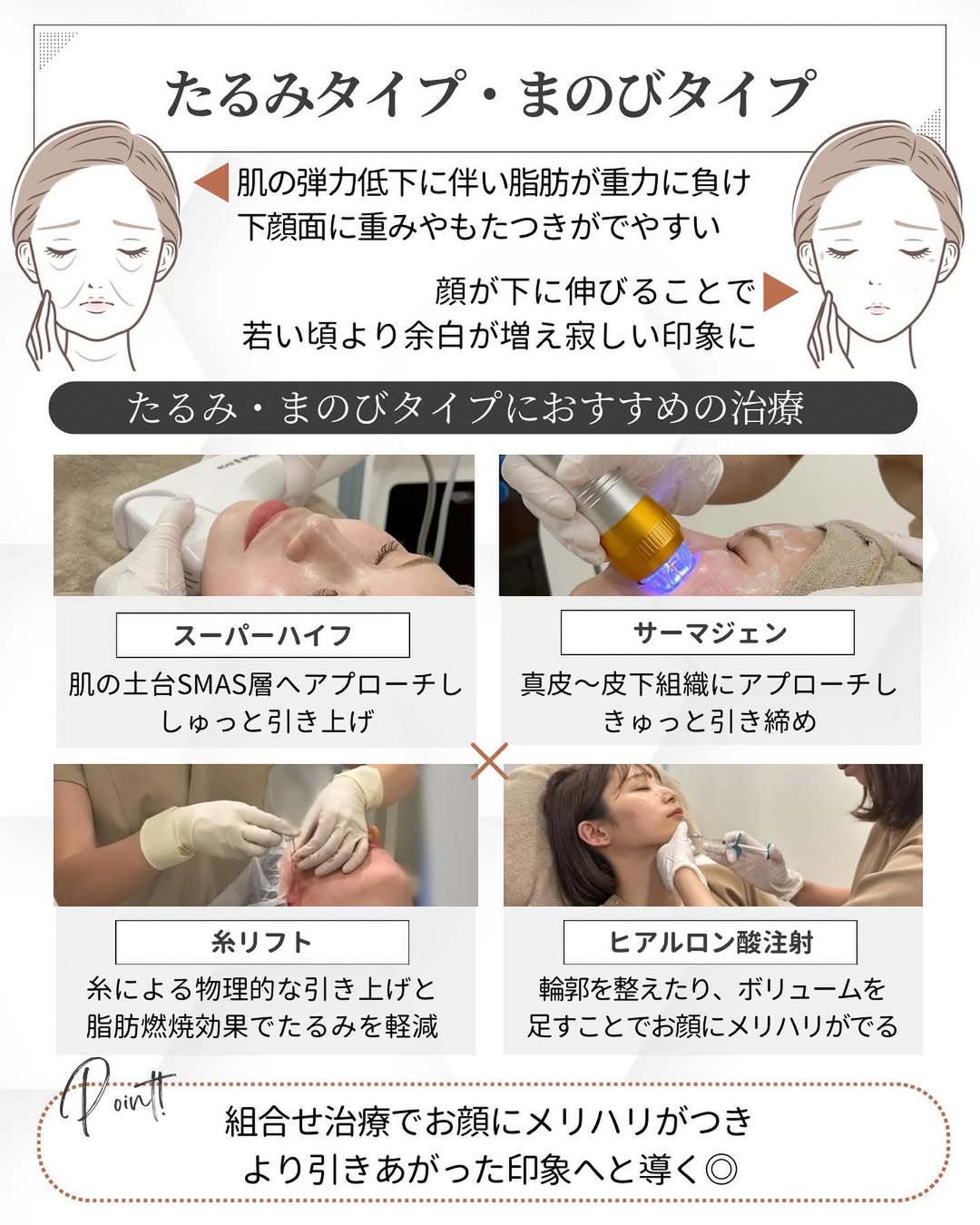 たるみ・まのびタイプにおすすめの治療「スーパーハイフ」、「サーマジェン」、「糸リフト」、「ヒアルロン酸注射」