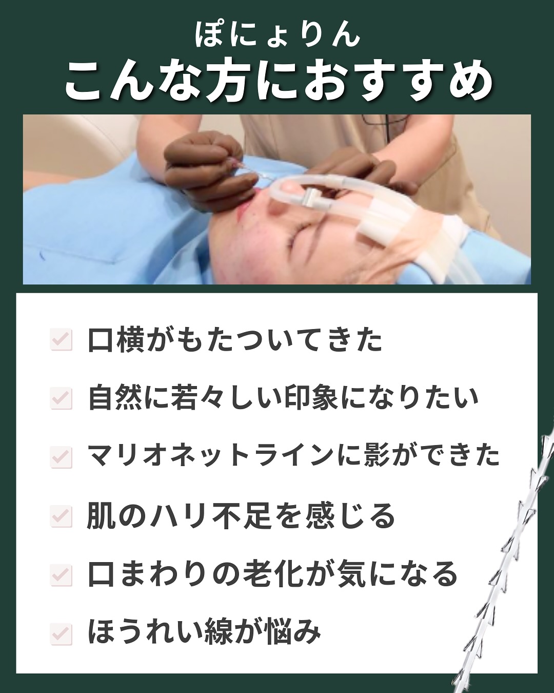 ぽにょりんはこんな方におすすめ
