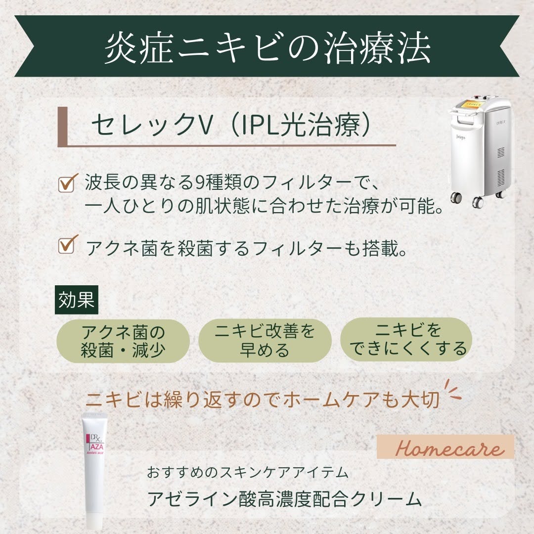 セレックV