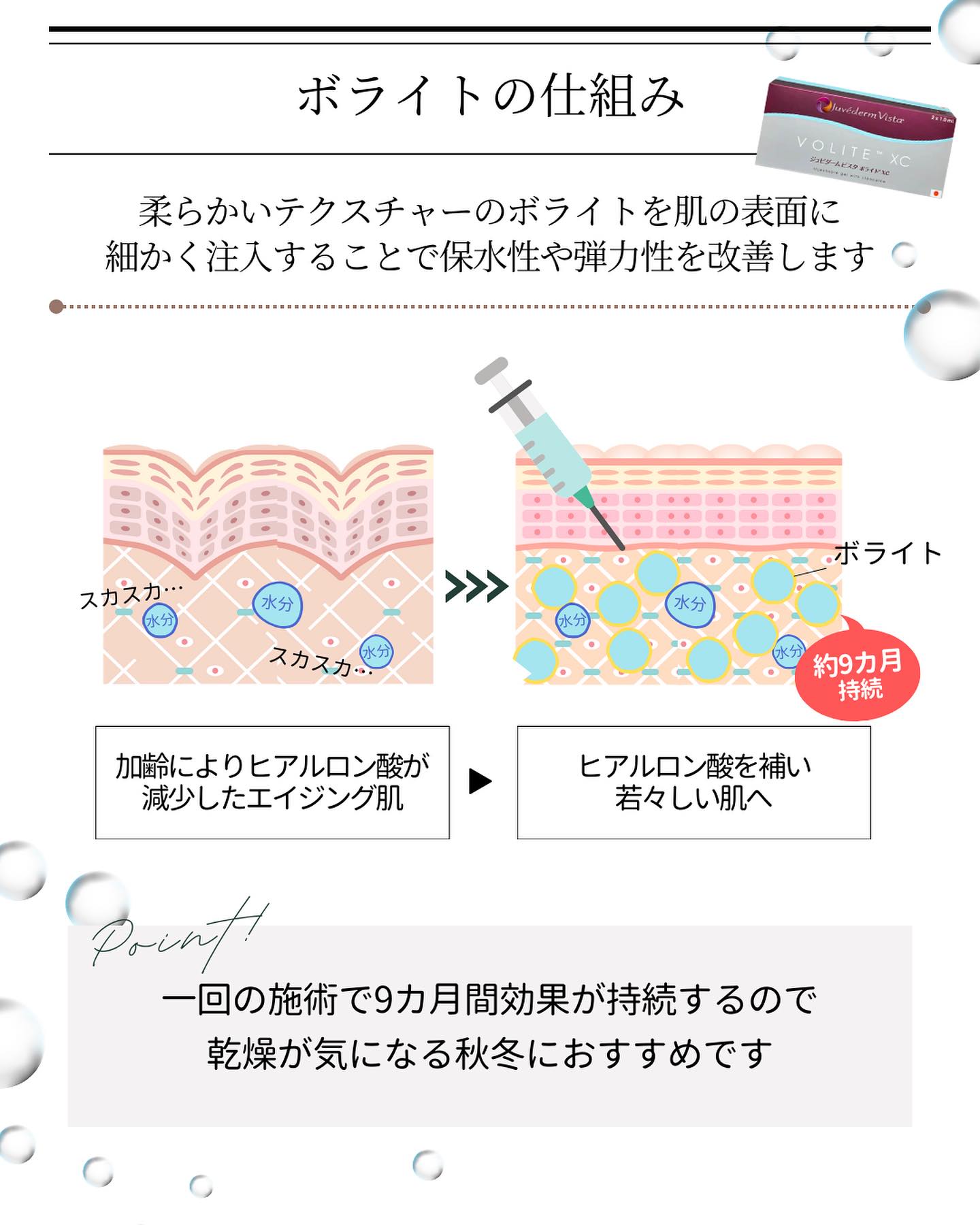 ボライトの仕組み