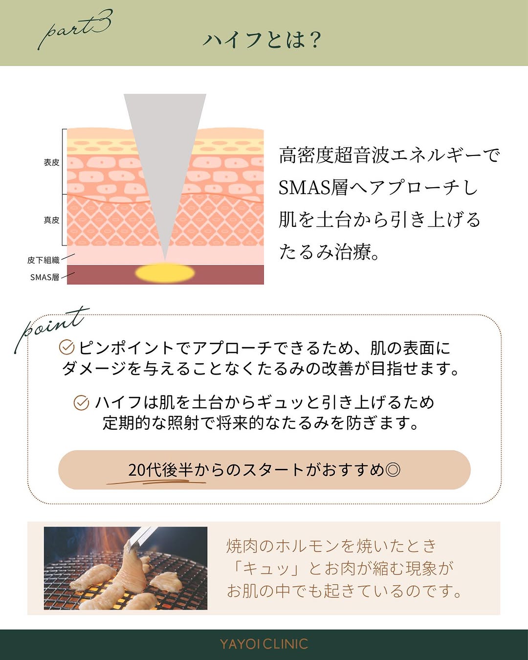 ハイフとは?