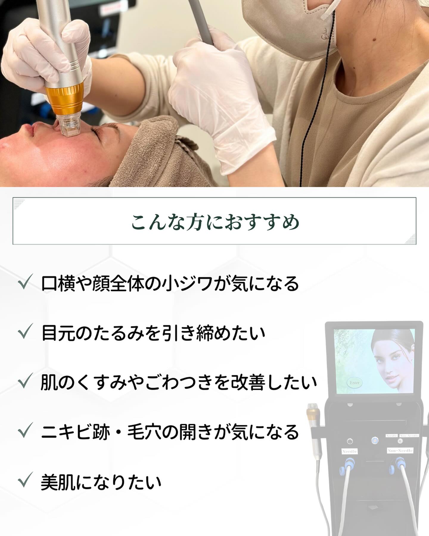 サーマニードルがおすすめの人