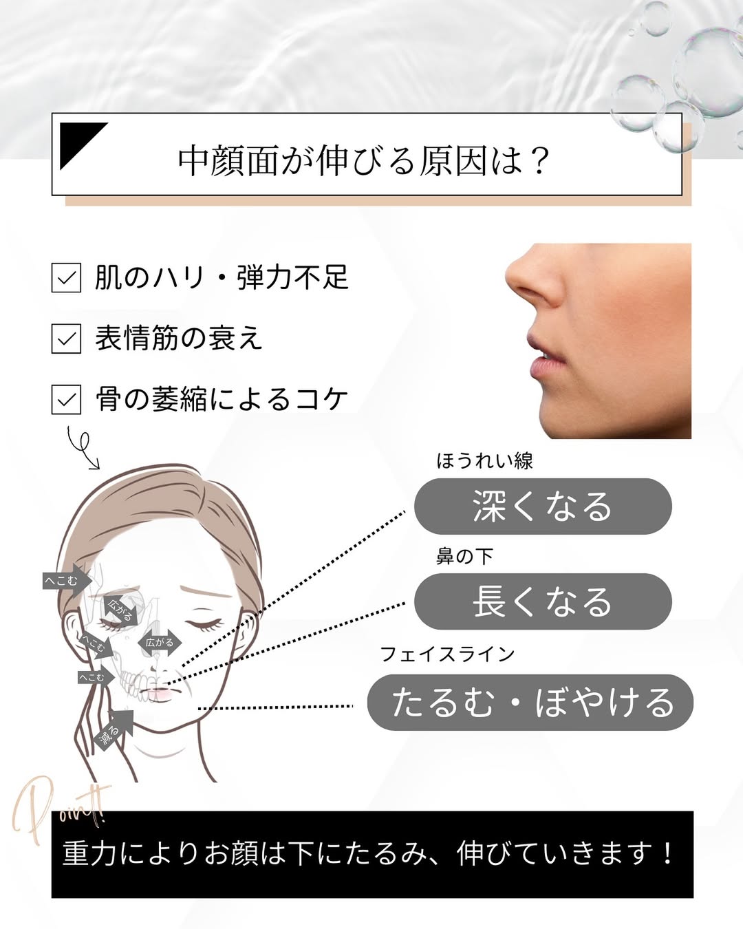 中顔面が伸びる原因