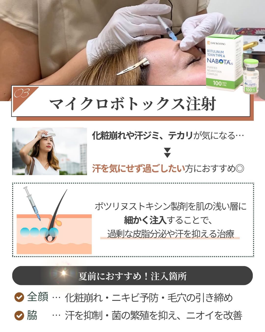 化粧崩れや汗ジミを抑えるマイクロボトックス注射