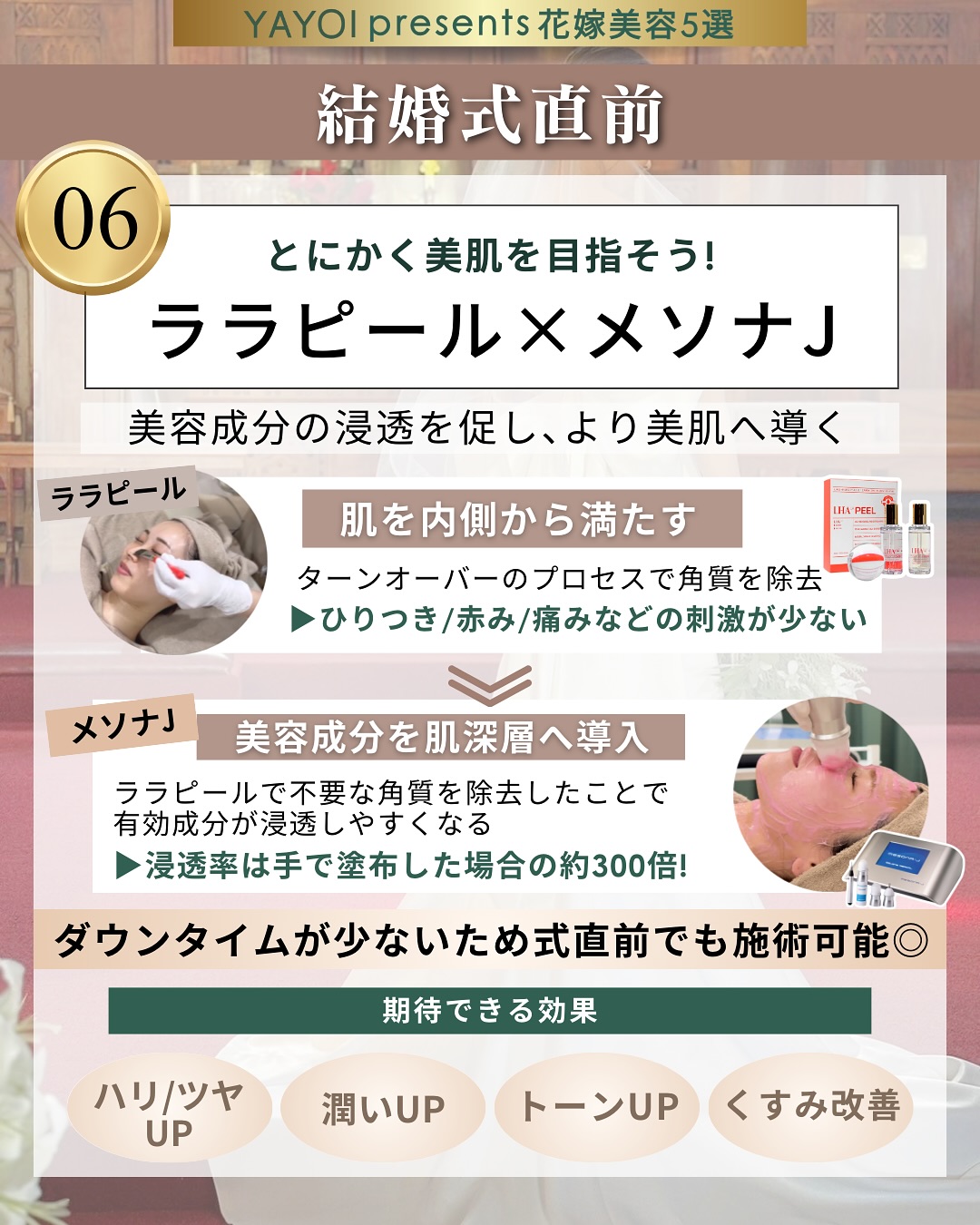 ララピール×メソナJ