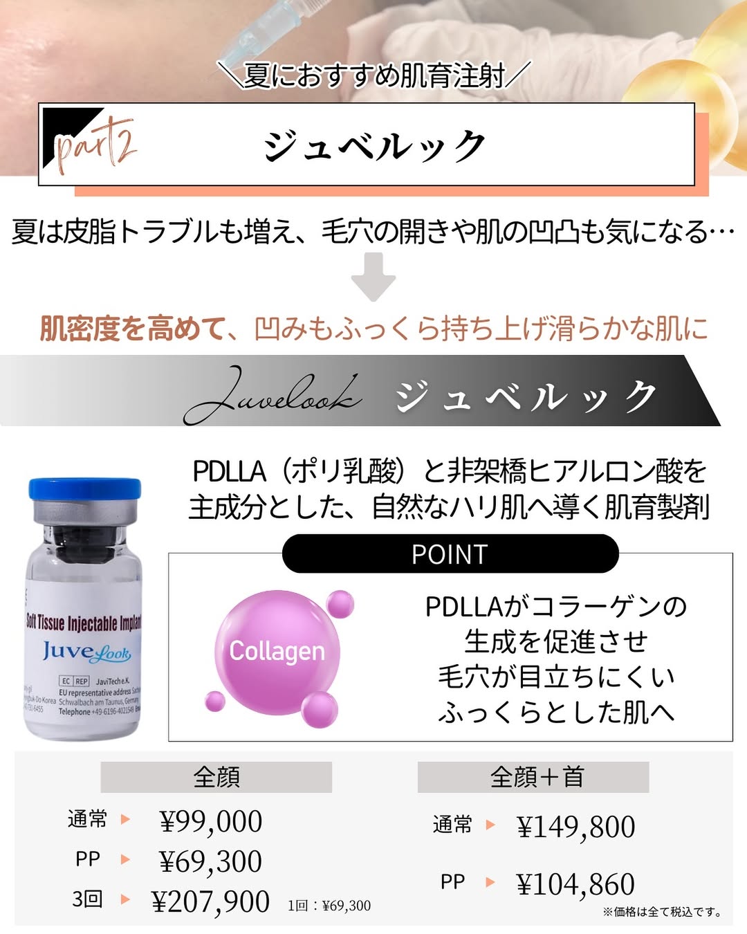 ジュベルック