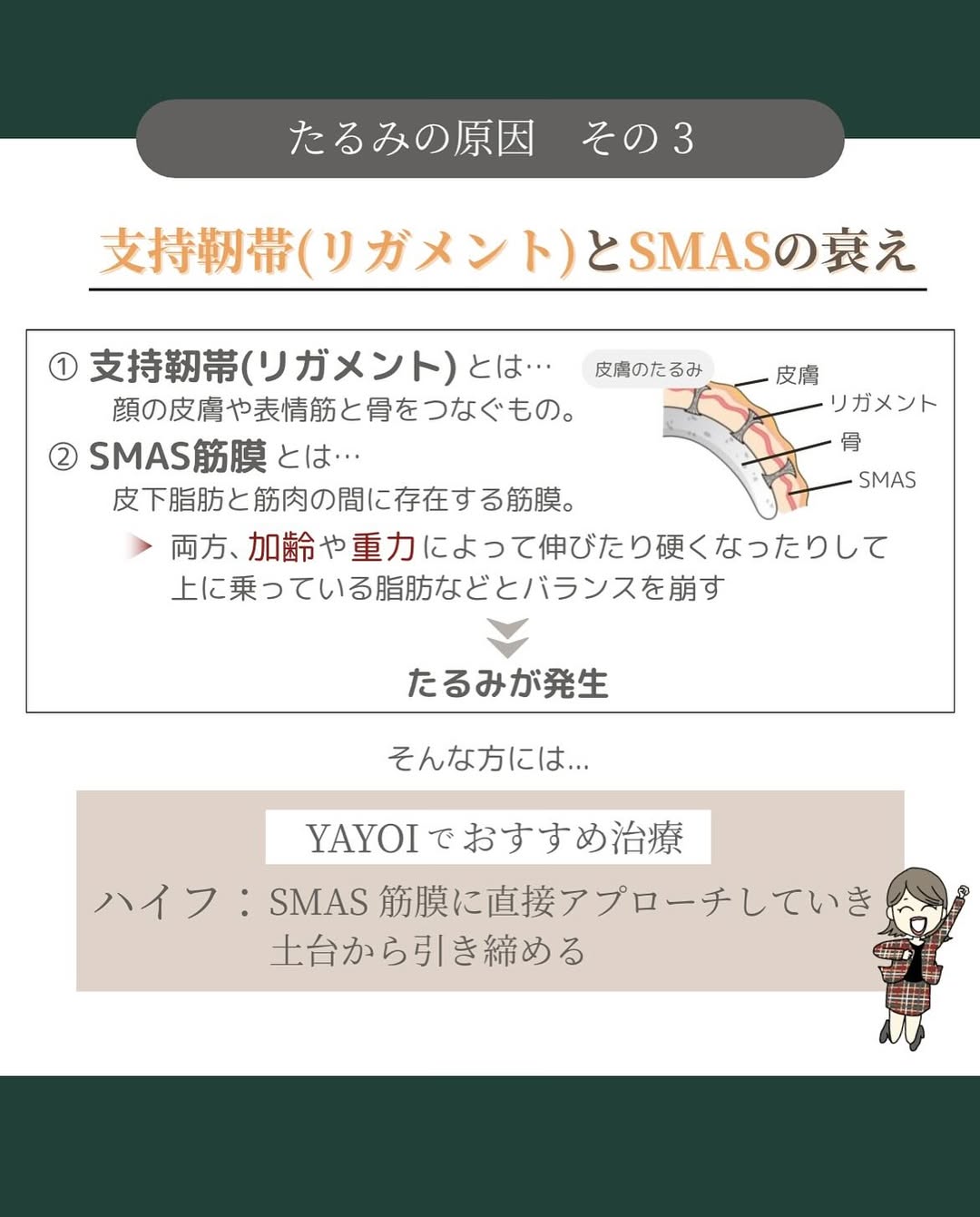 たるみの原因3つ目は支持靱帯(リガメント)やSMASの衰え