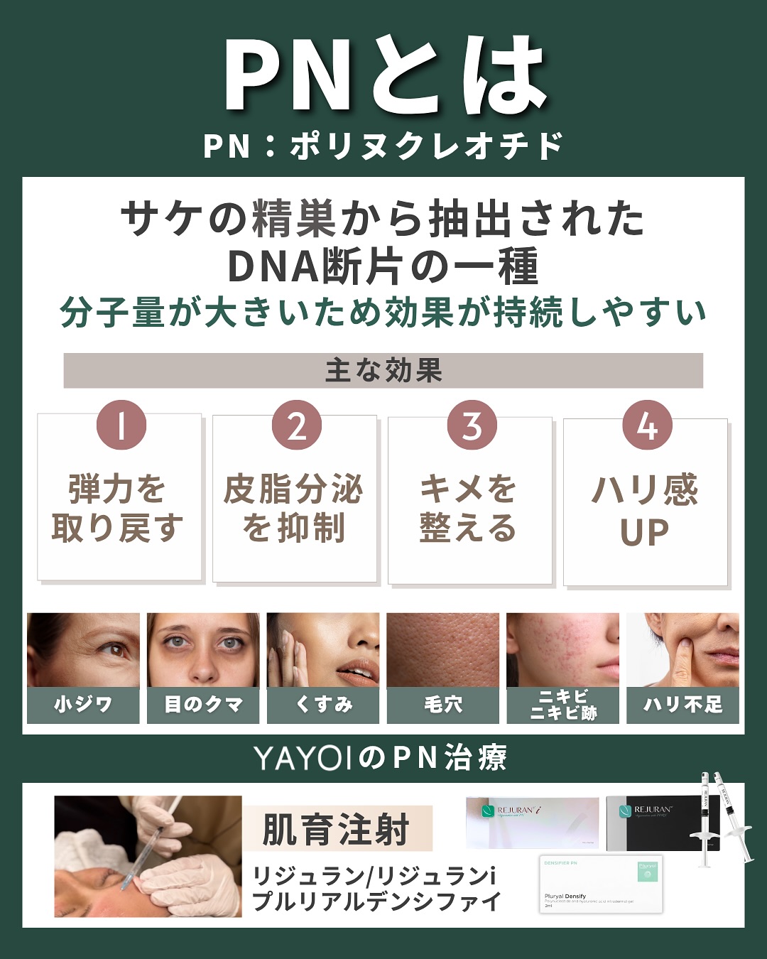 PNの特徴