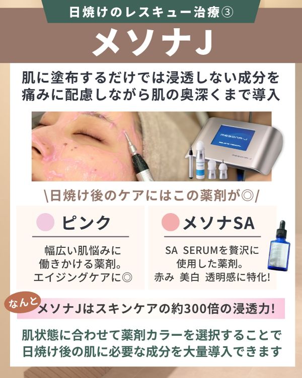 メソナJ
