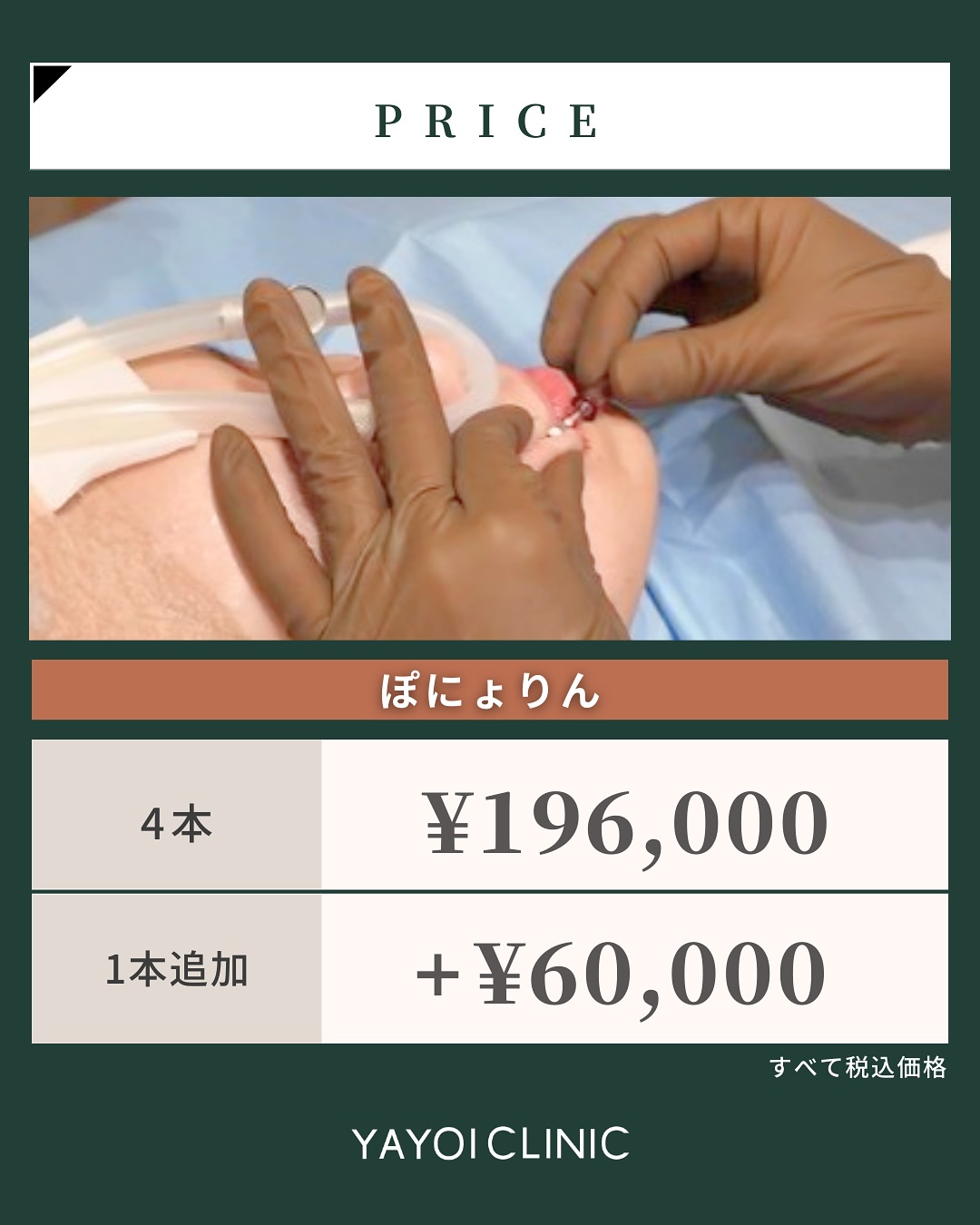 ぽにょりんの料金表