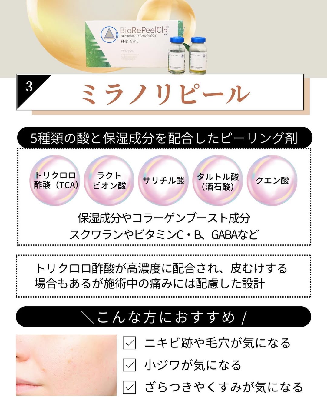 ミラノリピール