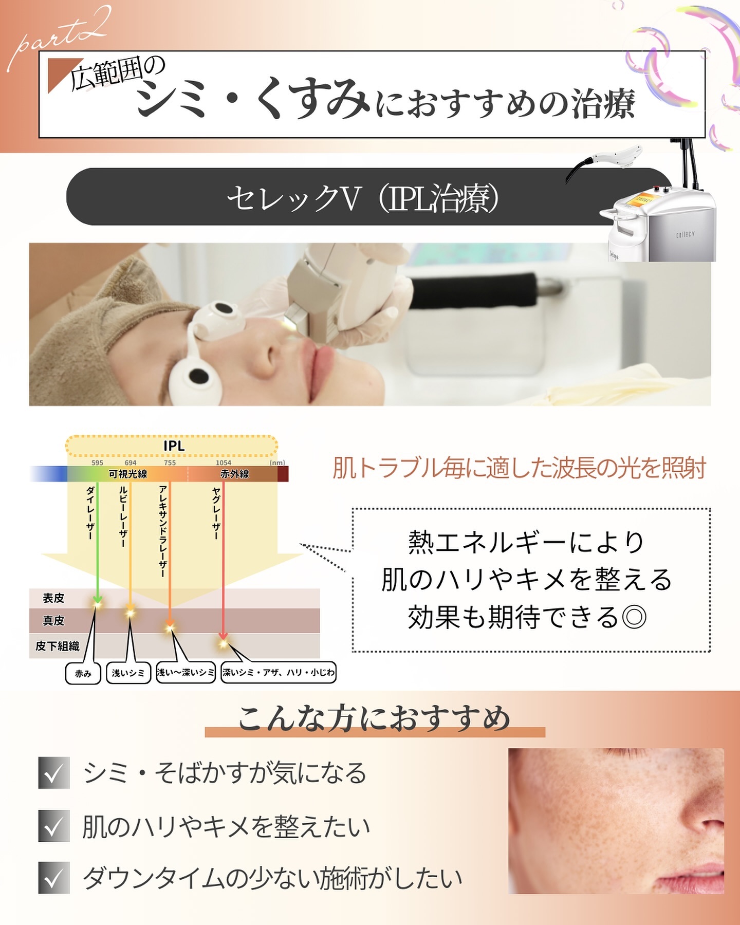 セレックVを受ける女性の写真と施術内容