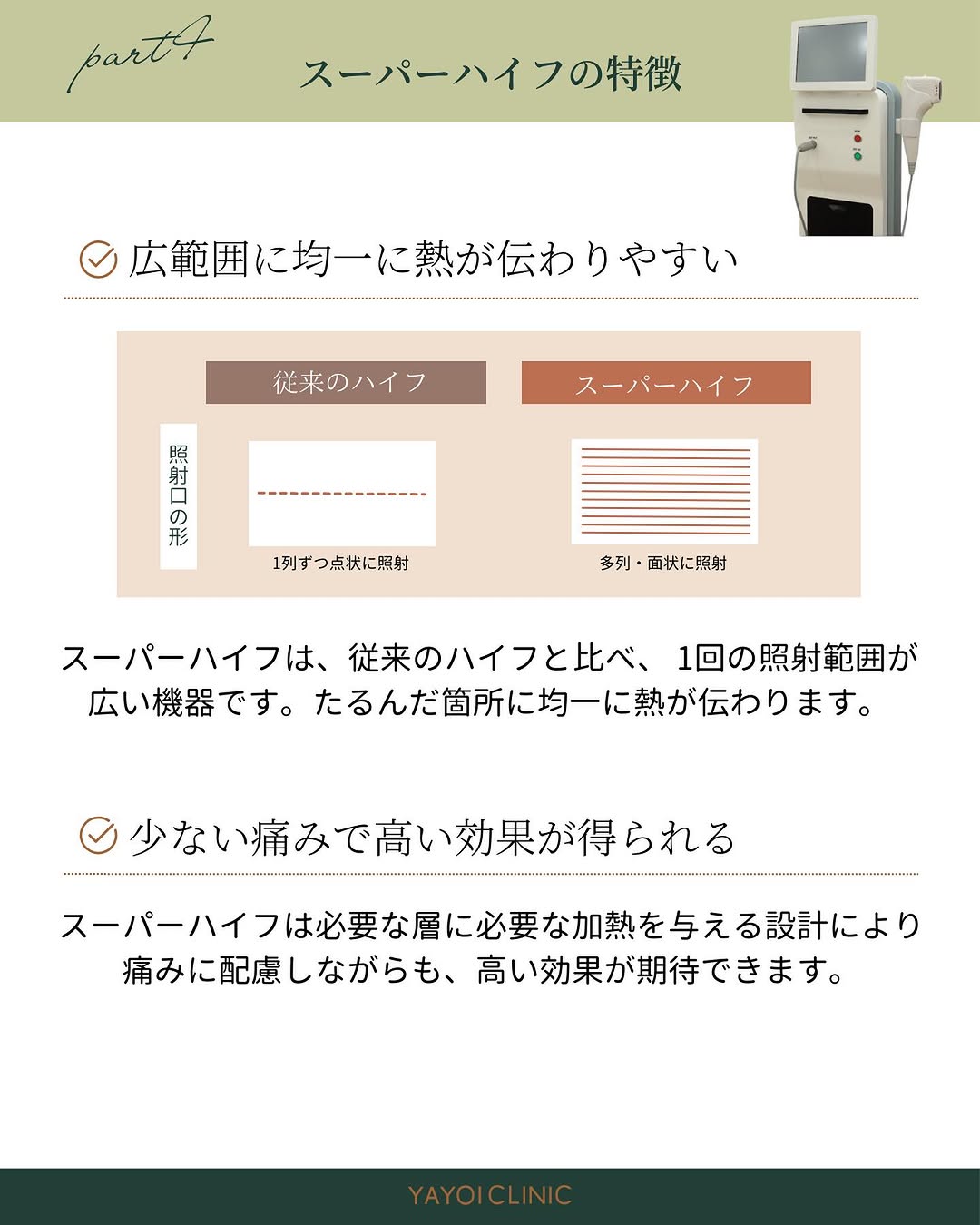 スーパーハイフの特徴