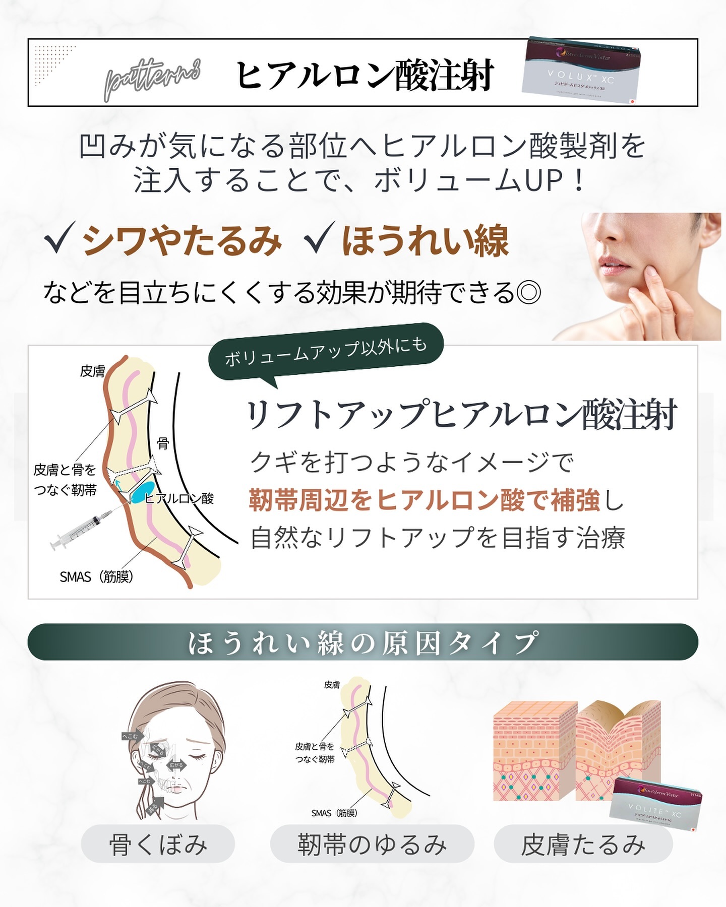 ほうれい線治療「ヒアルロン酸注射」の仕組み