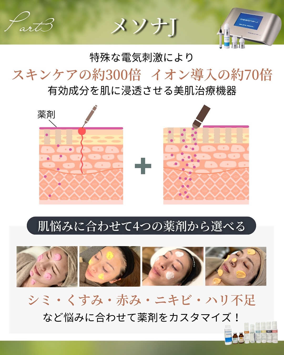 メソナJ