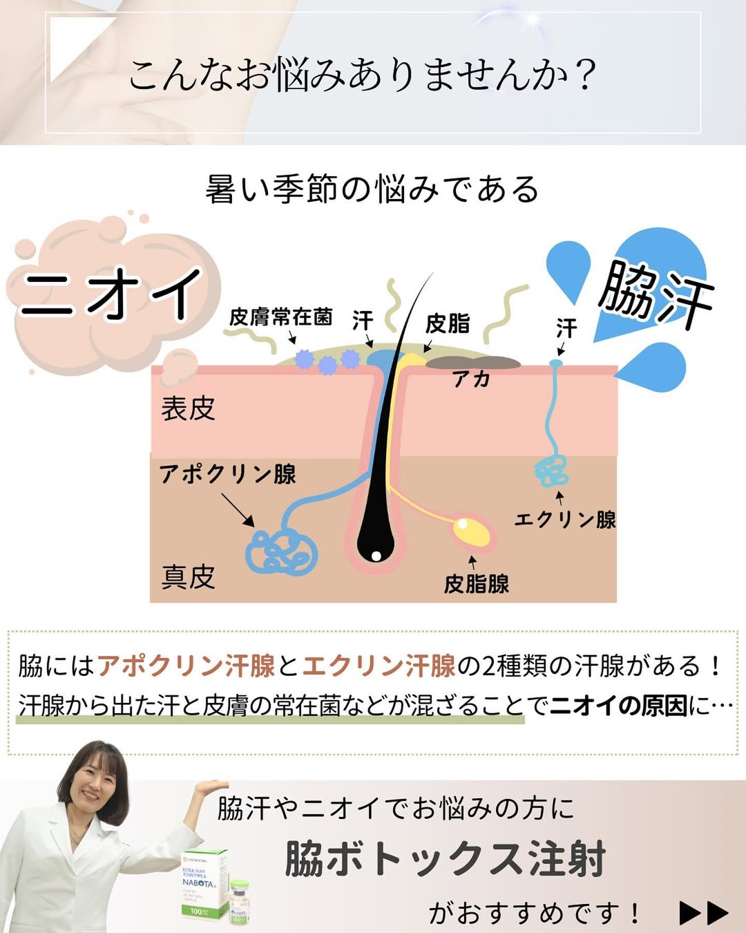 暑い季節の悩みに脇ボトックス注射がおすすめ