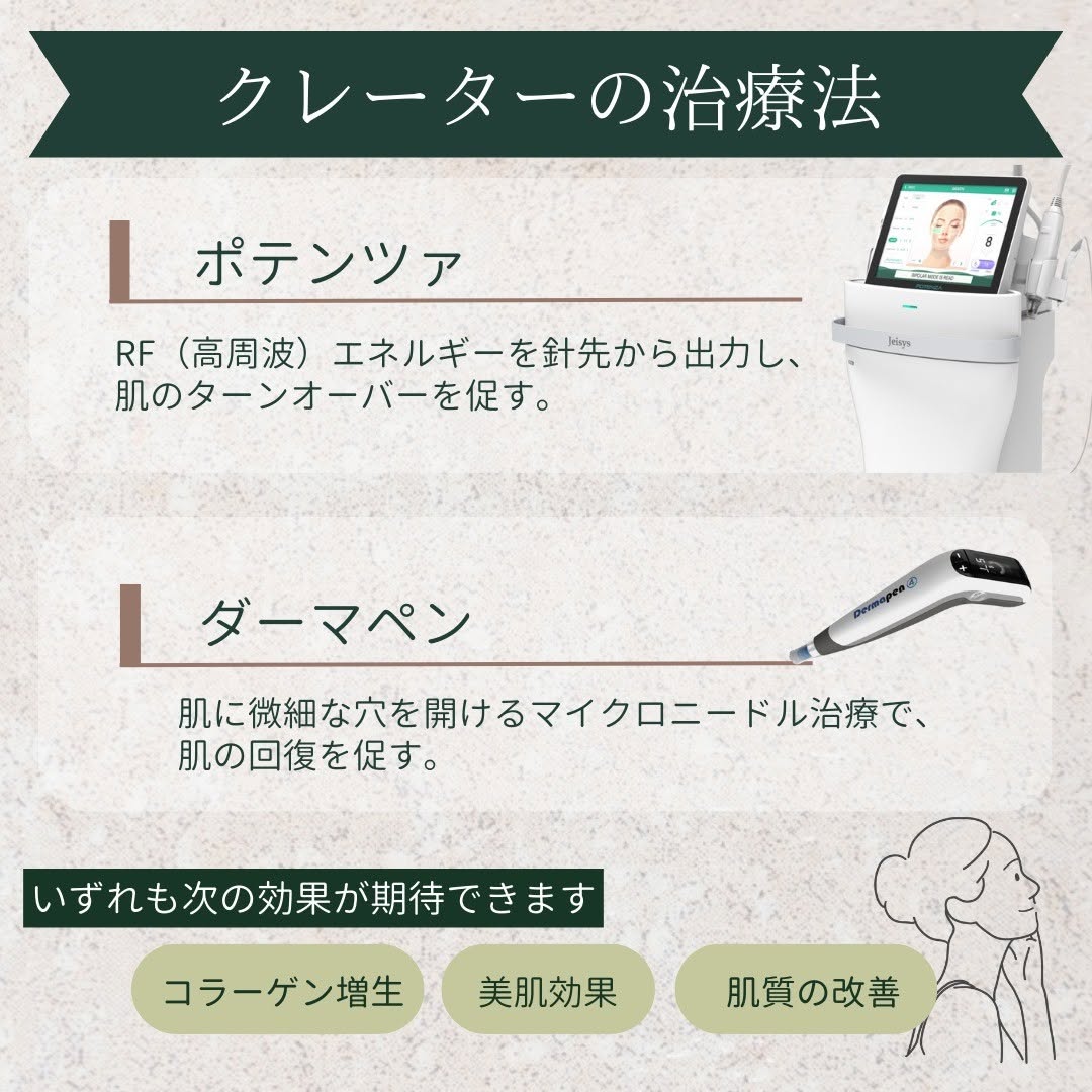 ポテンツァ、ダーマペン