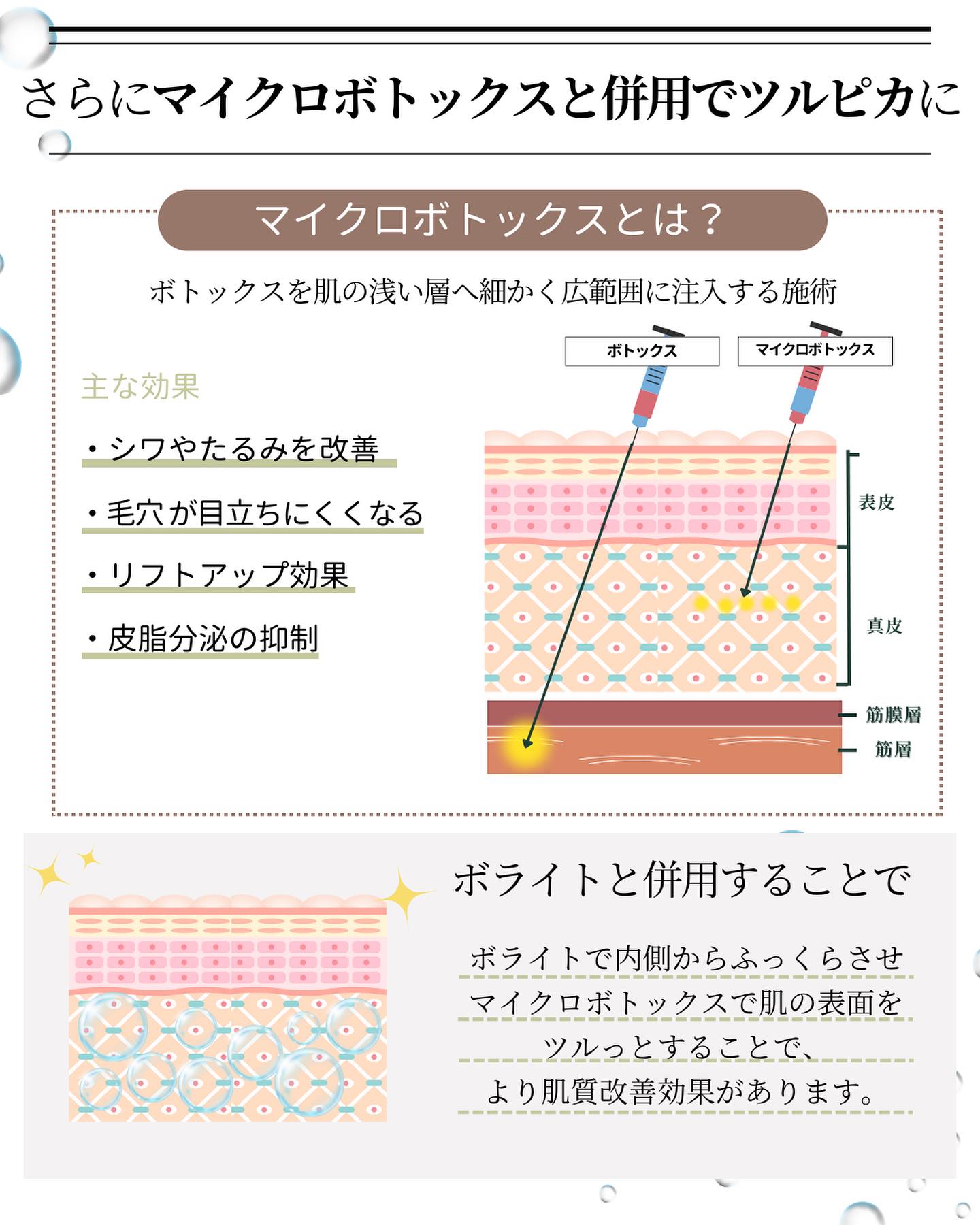 マイクロボトックスとは？