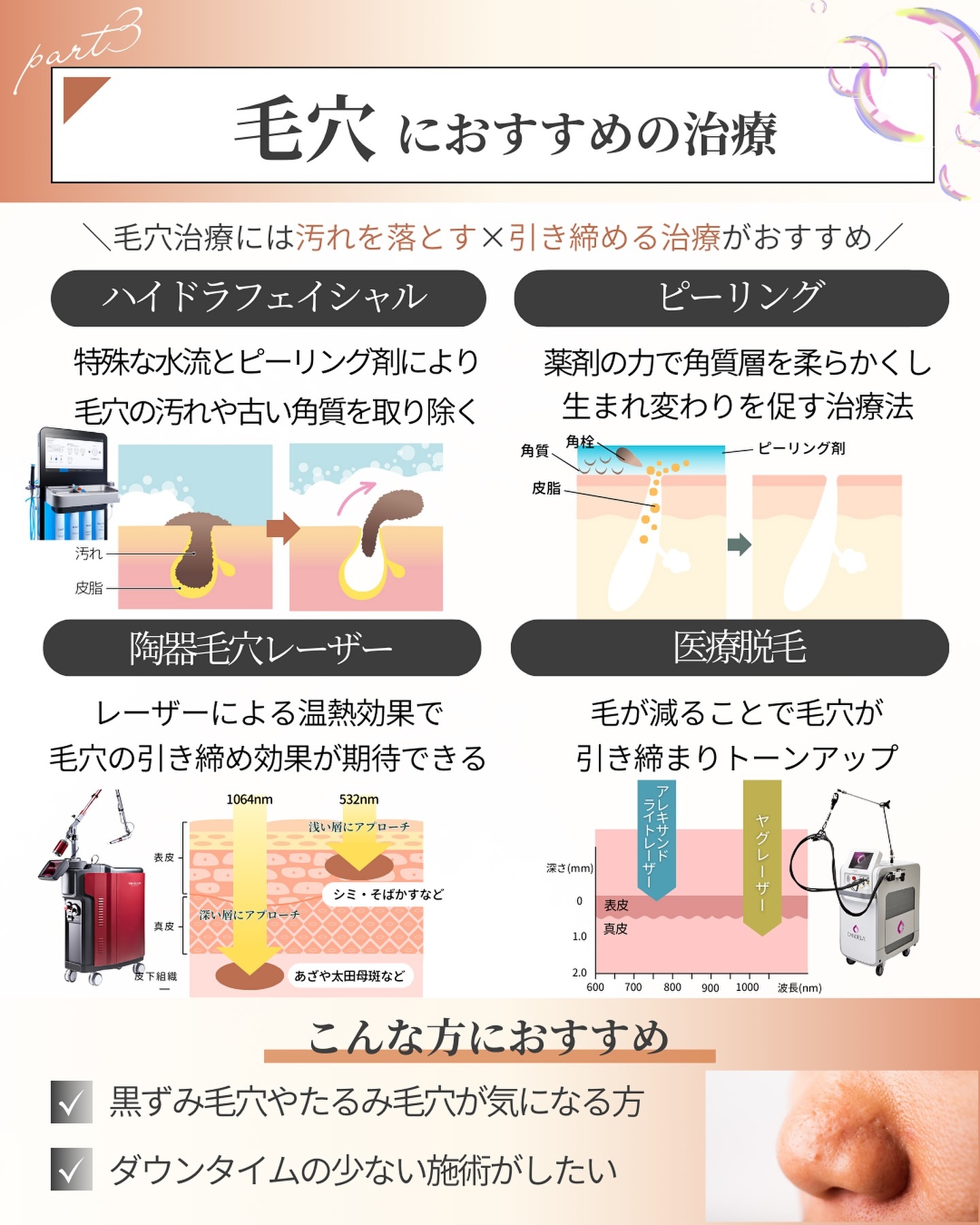 毛穴におすすめの施術4選