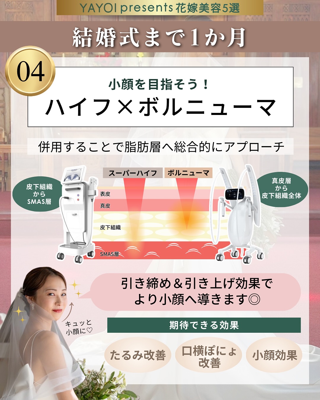 ハイフ×ボルニューマ