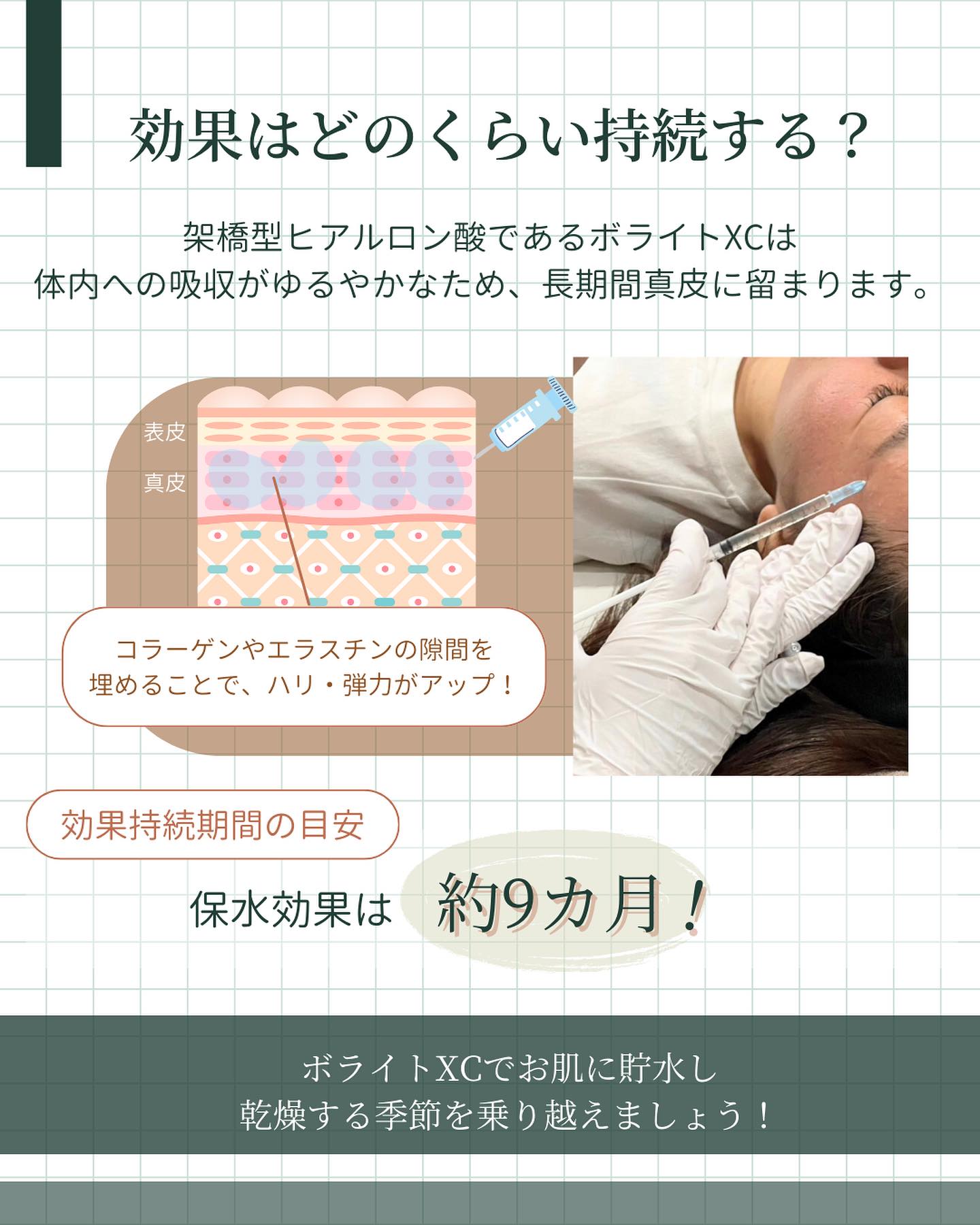 ボライトXCの効果持続期間