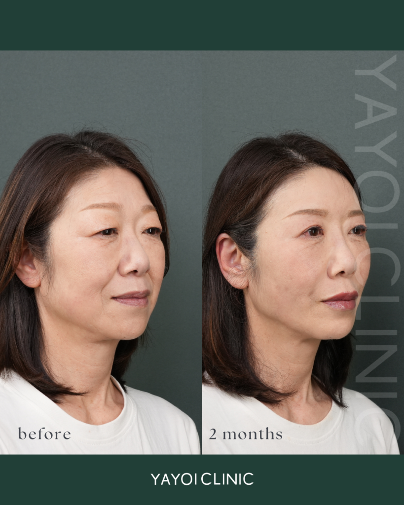 美容外科 眉下切開＋上眼窩脂肪切除、糸リフト、経結膜脱脂術、脂肪吸引、脂肪注入、ヒアルロン酸注射、ボトックス注射